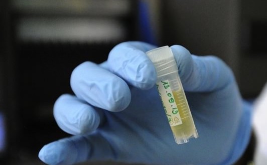 HIV origins traced to 1920s Kinshasa, Study