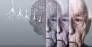 Memory loss associated with Alzheimer’s reversed for first time, Study