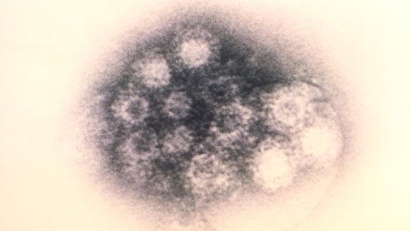 New Jersey confirms first death of child due to enterovirus