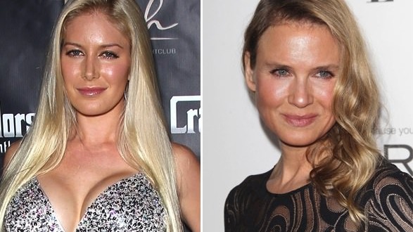 Plastic surgery queen Heidi Montag conveys ’empathy’ for Renee Zellweger