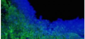 Researchers engineer toxin-secreting stem cells to treat brain tumors