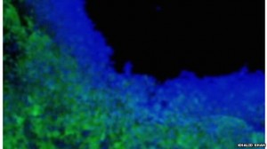 Researchers engineer toxin-secreting stem cells to treat brain tumors