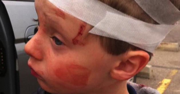 Six-Year-Old boy attacked on school bus now recovering
