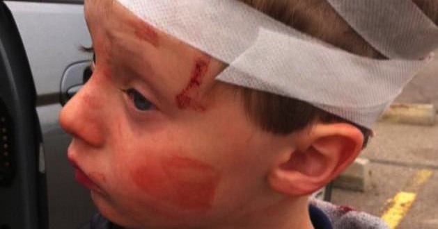 Six-Year-Old boy attacked on school bus now recovering
