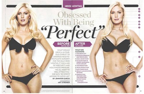 Heidi Montag : Reality star Says She's 'Done' with Plastic Surgery
