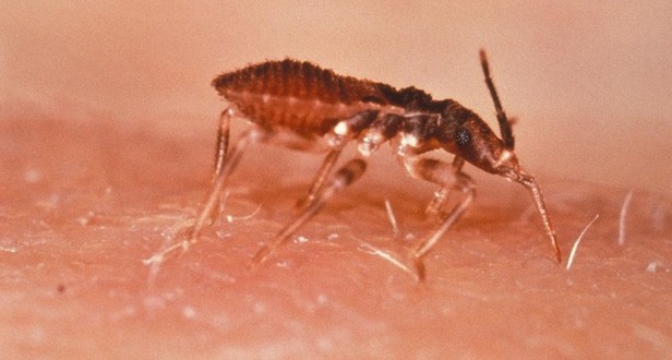 Kissing Bug Spreading Tropical Disease In U.S. (Video)