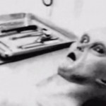 UFO Expert Releases 'Authentic' Images of Alien Autopsy (Photo)
