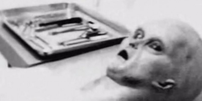 UFO Expert Releases ‘Authentic’ Images of Alien Autopsy (Photo)
