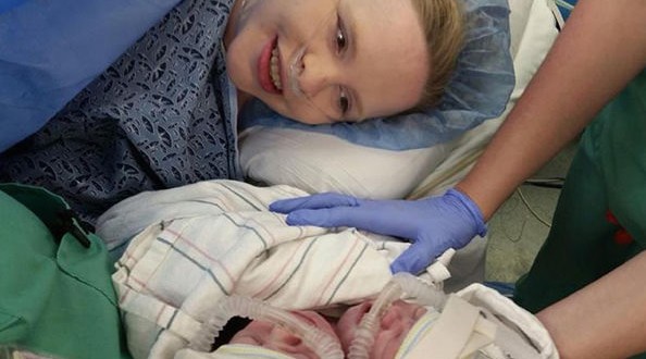 Conjoined Twins Die At Georgia Hospital A Day After Birth (Video)