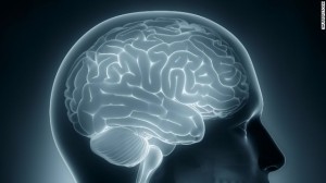 Diabetes Ages the Brain 5 Years Faster than Normal, New Study