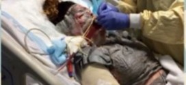 Friend's Antibiotic Brings Life-threatening Reaction - Video: Teen takes antibiotic, burns 'from inside-out'