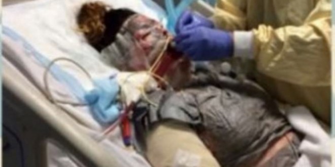 Friend’s Antibiotic Brings Life-threatening Reaction – Video: Teen takes antibiotic, burns ‘from inside-out’