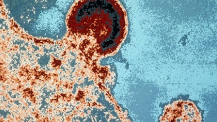 HIV evolves into less deadly form, New Study