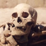 Researchers find cancer in man who died 4500 years ago