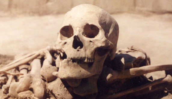 Researchers find cancer in man who died 4500 years ago