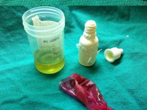 A vial of urine hidden in rectum (Photo)