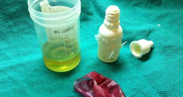 A vial of urine hidden in rectum (Photo)