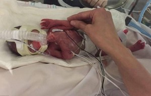Doctors Deliver Baby After Mom Dies In Crash (Video)