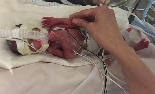 Doctors Deliver Baby After Mom Dies In Crash (Video)