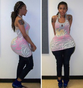 Glue in Buttocks : Butt injection suspect Oneal Morris asks judge for bond