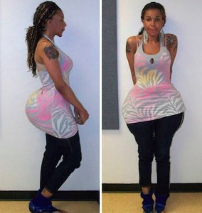Glue in Buttocks : Butt injection suspect Oneal Morris asks judge for bond