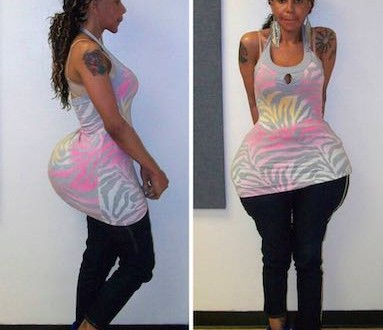 Glue in Buttocks – Butt injection suspect Oneal Morris asks judge for bond