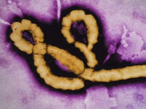 Possible case of Ebola in Quebec, deemed low-risk