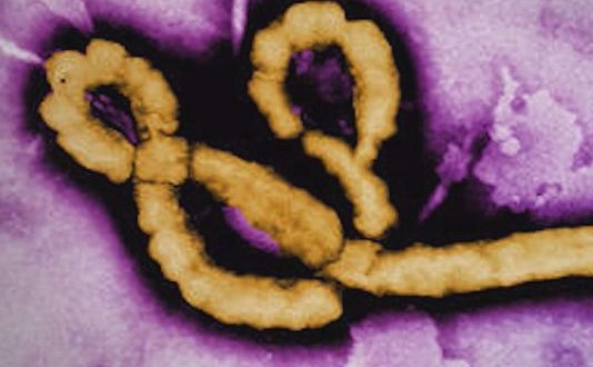Possible case of Ebola in Quebec, deemed low-risk