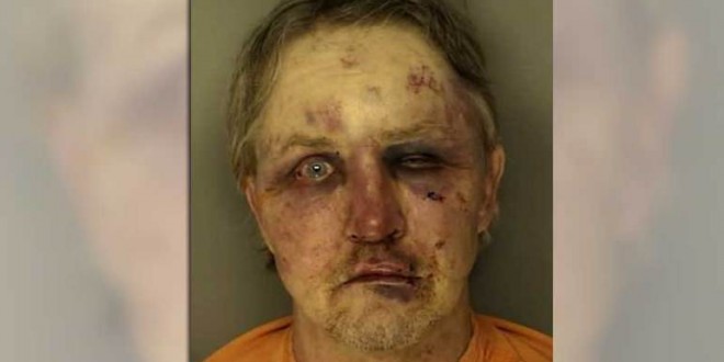 Rape suspect beaten by boyfriend of victim (Photo)