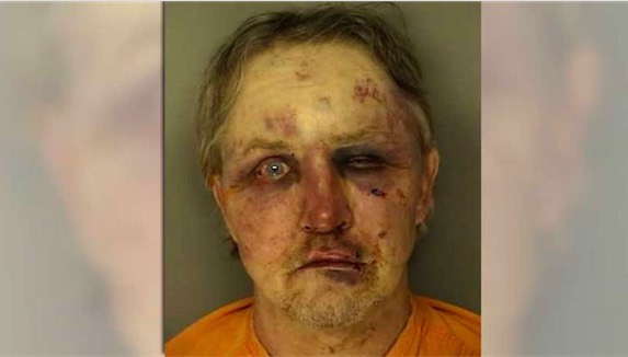 Rape suspect beaten by boyfriend of victim (Photo)