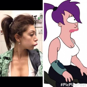 Teen Mom Farrah Lip Procedure - Photo : Teen Mom Star Farrah Abraham Reveals Botched Lip Injections