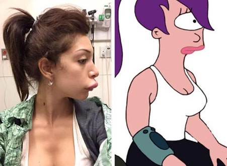 Teen Mom Farrah Lip Procedure Teen Mom Star Farrah Abraham Reveals Botched Lip Injections Teen Mom Farrah Lip Procedure Teen Mom Star Farrah Abraham Reveals Botched Lip Injections