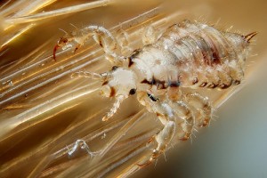 Girl Dies During Head Lice Treatment, say police