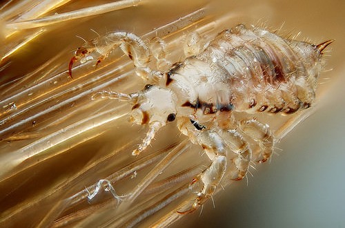 Girl Dies During Head Lice Treatment, say police
