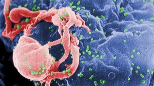 New HIV strain detected in Cuba, Develops Into AIDS Very Fast