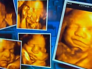 3-D Ultrasounds Could Be Dangerous, FDA : Study