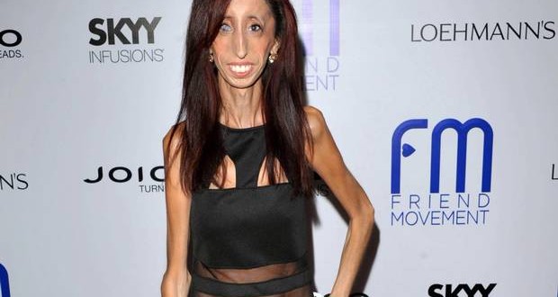 World's Ugliest Woman : Lizzie Velasquez Proves Her Haters Wrong By Releasing A Documentary! (Trailer)