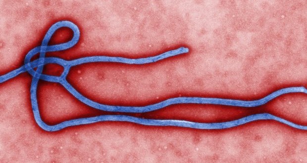 Ontario patient with Ebola-like Symptoms Tests Negative