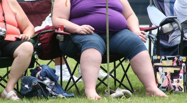 Post-surgery complications high for obese patients, new study says