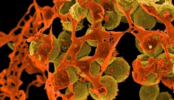 Scientists Use Medieval Remedy to Kill Modern Superbug
