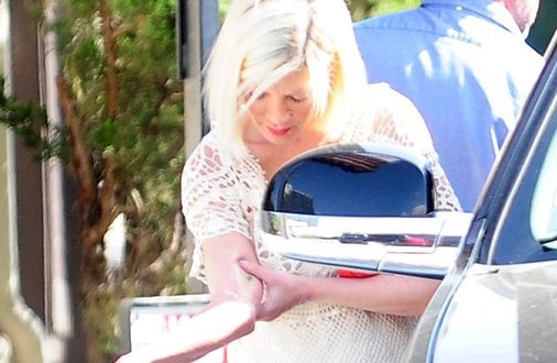 Tori Spelling : Star Suffers ‘Benihana Burn,’ Undergoes Skin Grafts