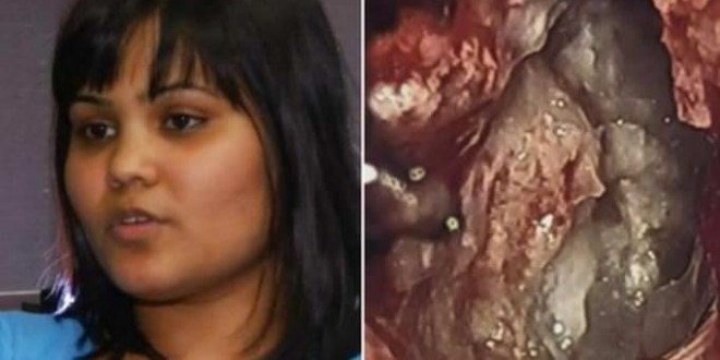 Yamini Karanam : Woman's brain tumor turns out to be "evil twin" (Video)