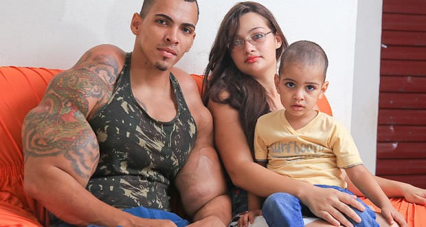 Romario Dos Santos Alves risks his life by injecting oil into his biceps (Video)