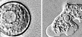 Brain-eating amoeba kills 21-year-old woman in Bishop, California