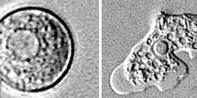 Brain-eating amoeba kills 21-year-old woman in Bishop, California