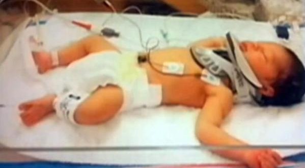 Nurse Drop Newborn Baby? Newborn fractures skull after being dropped by Pa. nurse; investigation underway (Video)