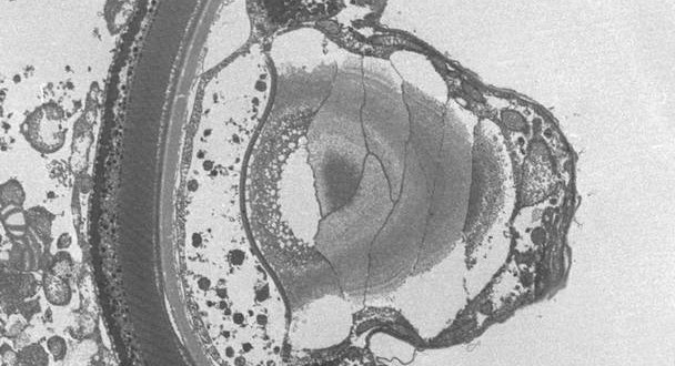 Single-celled predator evolves tiny, human-like ‘eye’, New Study