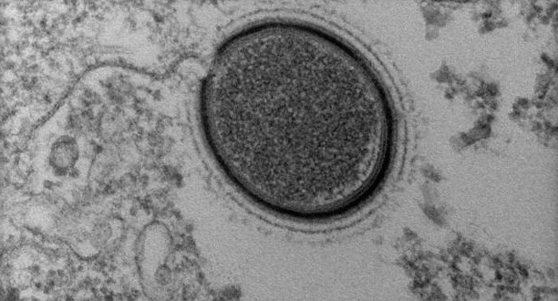 Scientists Discover, Revive Giant Prehistoric Virus from Permafrost