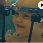 Internally decapitated toddler undergoes 'miracle' surgery (Video)