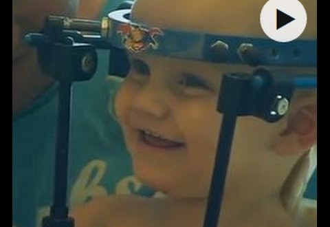 Internally decapitated toddler undergoes ‘miracle’ surgery (Video)